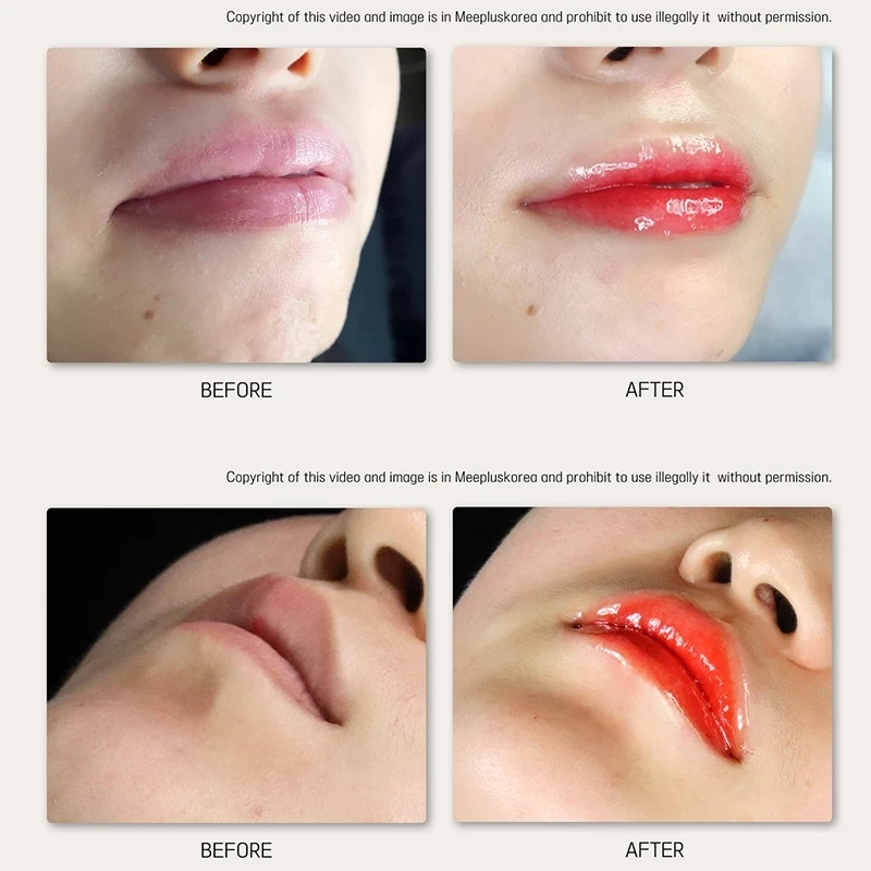 8ML Novo BB Krema za Ustnice korejski Ustnice Make-Up Kozmetika Ampul Bistvo Lepote Starter Set je Primeren Sor Novinci Treh Barvah Fashion 5