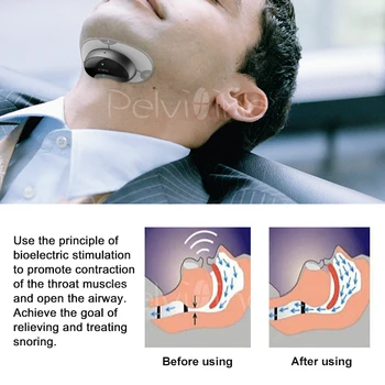 Smart Smrčijo Zamašek Anti Smrčijo ronco Rešitev udobno anti Smrčanje Biosensor z APP in spanje apnea monitor CPAP replacer 4